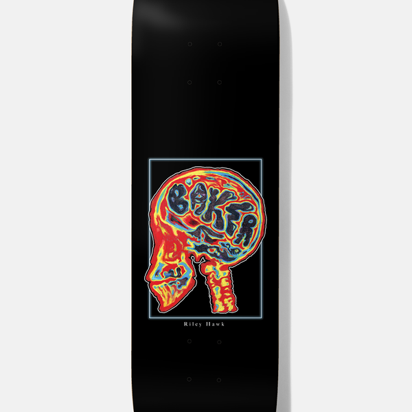 RH-Brain-Donor-8-DW85-